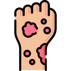 rash